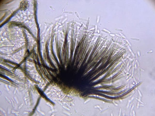 Microscopia de Colletotrichum spp. - Agente causal de antracnosis